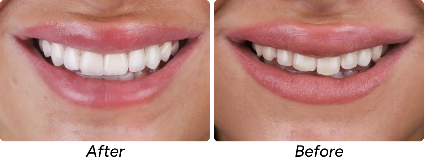 Estetica Dentara poza 2